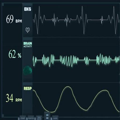 Técnicas de aplicación e interpretación de Electrocardiograma 